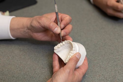 Dentist working on a mold of upper row of teeth