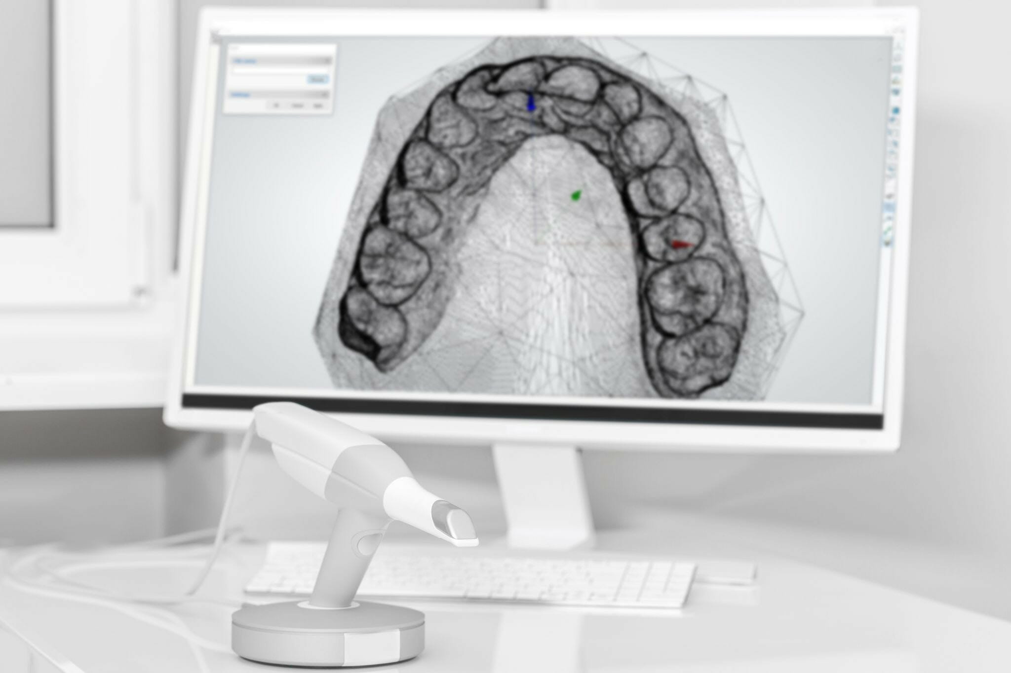Digital Smile Design on desktop monitor